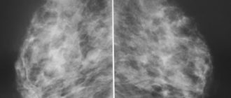 Диффузный ФАМ