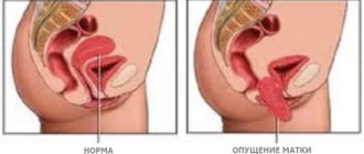 Дискомфорт во влагалище во время беременности