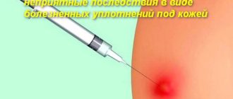 Воспалилась старая шишка от уколов