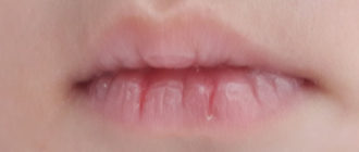 Что может быть если ребёнок проснулся побледнел обмяк побелели губы