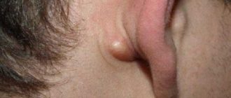 Внезапно поивились пятна белые на шеи за ухом низ уха