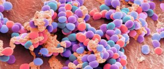 Впч 16,18, Lactobacillus, Enterobacteriaceae, Staphylococcus, Gardnerella, и др