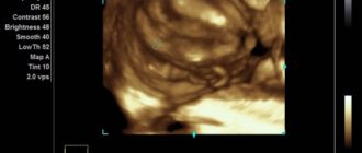 Может ли ошибаться врач узист?