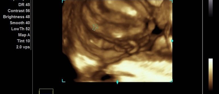 Может ли ошибаться врач узист?