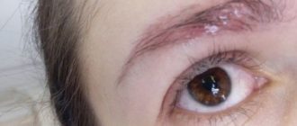 В бровях вавки