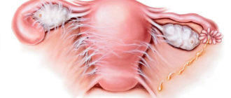 Всегда ли спайки после хламидиоза?