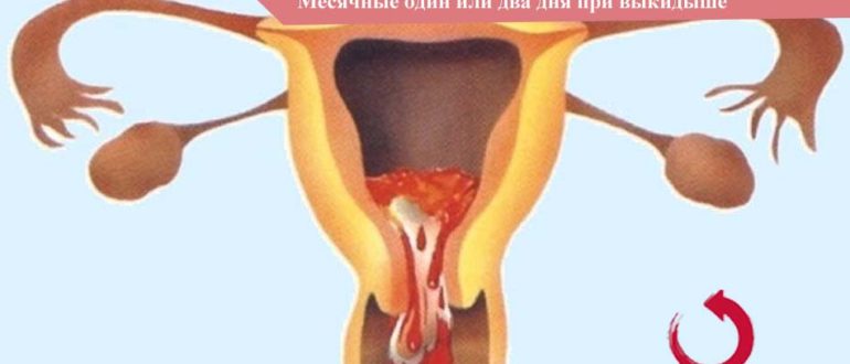 Месячные шли один день причины