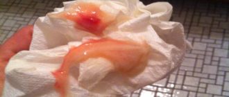 Выделения как молочница только розовое что это?