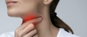 Длительное время больно глотать