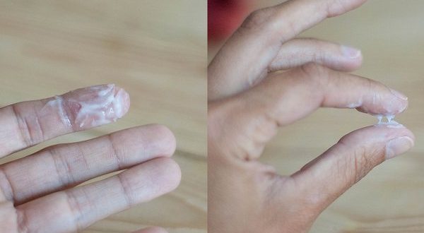 Выделения с резким запахом после Лактожиналь