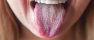 Налет на языке