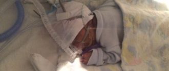 Возможно ли спасти ребёнка 28недель, отошли воды неделю назад