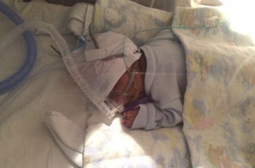 Возможно ли спасти ребёнка 28недель, отошли воды неделю назад