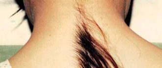 Волосы на шее у ребенка