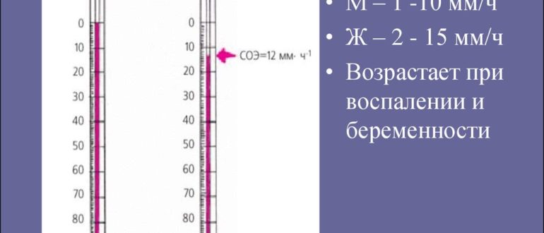 Высокая СОЭ 64мм/ч