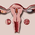 Вероятность беременности от спермы на полотенце