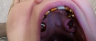 Что-то вскочило на небе