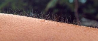 Мурашки по коже, ощущения в сердце