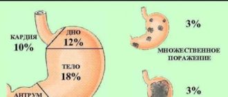 Может ли быстро развиться рак желудка?