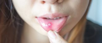 Внутренная часть губ