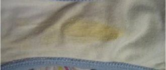 Выделения у девочки подростка