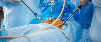 Эластофиброма. Нужна ли операция?