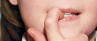 Детский невроз: кусаем губы, трогаем кожу рук