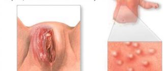 Чючють напухла малая половая губа