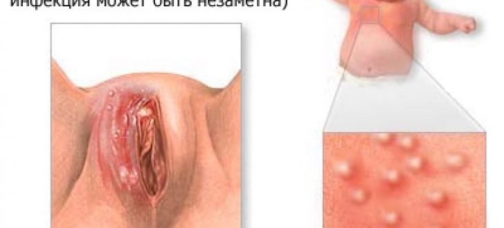 Чючють напухла малая половая губа