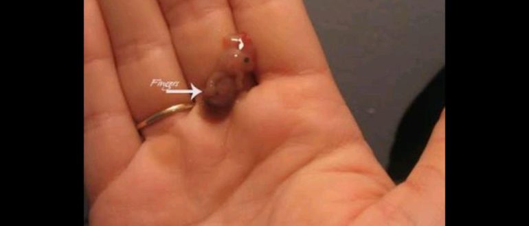 Выделения после самопроизвольного выкидыша на 14 неделе