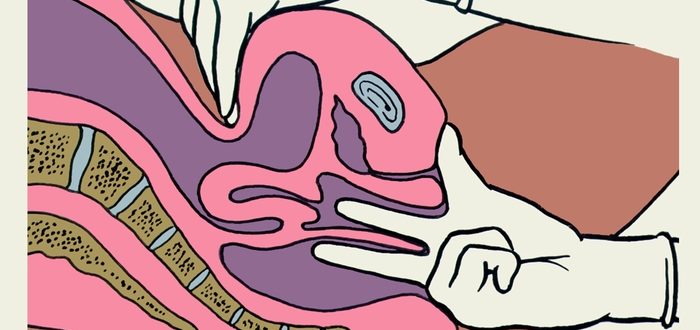 Во что упирается член во время секса?