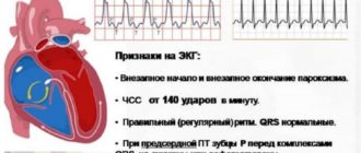 Частые головокружения при резком подъём, тахикардия от Мексидола