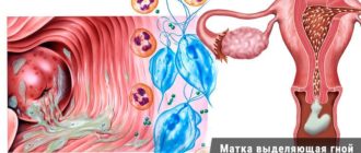 Видны ли в обычном бакпосеве из влагалища трихомонады?