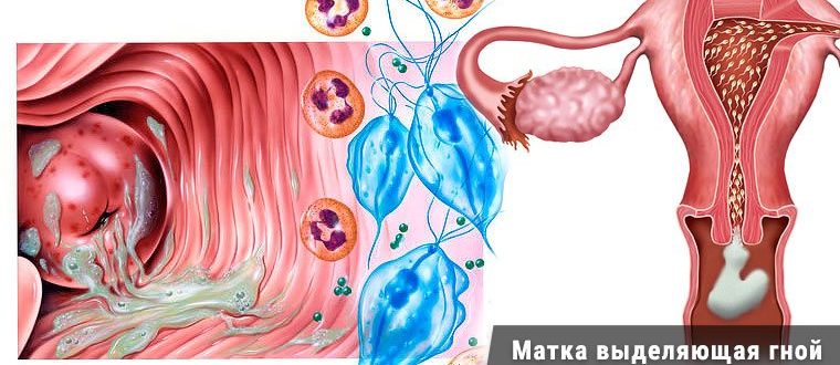 Видны ли в обычном бакпосеве из влагалища трихомонады?
