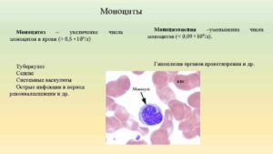 Моноциты в крови