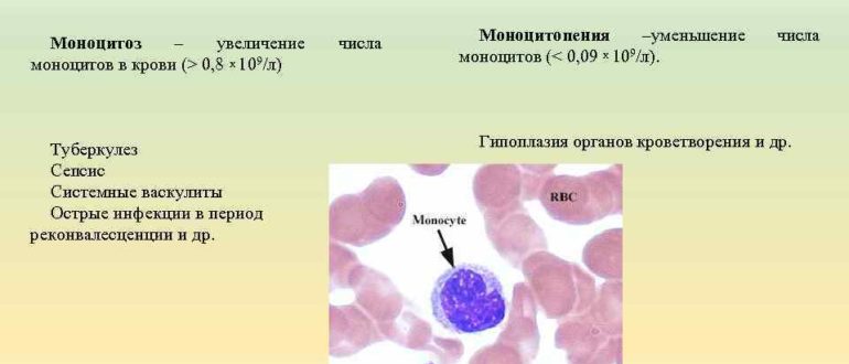 Моноциты в крови