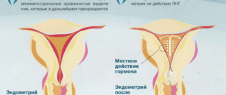 Влияют ли свечи на месячные