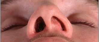 В носу что то мешает