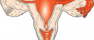 Воспаление яичников, молочница