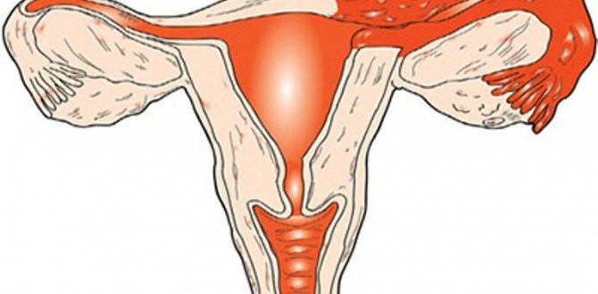 Воспаление яичников, молочница