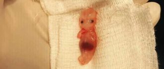 Выделения. Беременность 8-9 недель