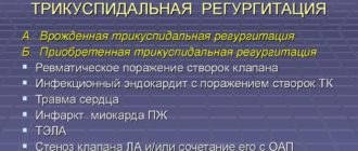 Минимальная - небольшая трикуспидальная регургитация