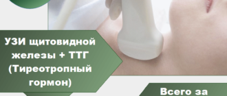Узи щитовидной железы и ттг