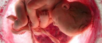 Дырочки в плаценте