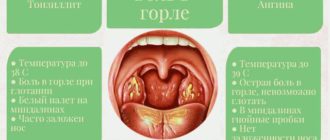 Что с горлом? Горло не болит температуры нет