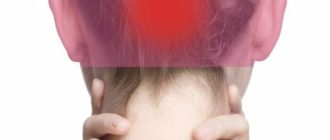 Дикие боли в голове