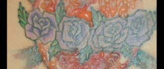 Волдыри на татуировке