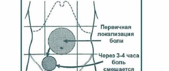 Может ли аппендицит болеть 3 дня? Сильной боли нет она уменьшается
