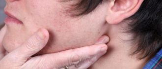 Дискомфорт под челюстью, чешется