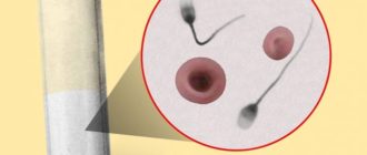 Моча и (сперма)